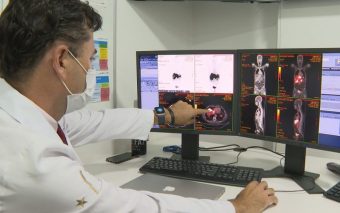 Conheça o novo tratamento para câncer de próstata