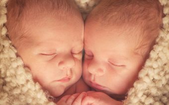 Revolução Cirúrgica: Como a Histórica Operação de Dr. Ben Carson Transformou o Futuro da Medicina de Gêmeos Siameses