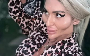 Conheça a mulher com as maiores bochechas do mundo