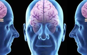 Tratamento do Alzheimer: Donanemab Retarda Doença em Estágios Iniciais