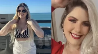 Empresária morre após realizar seis cirurgias plásticas simultâneas