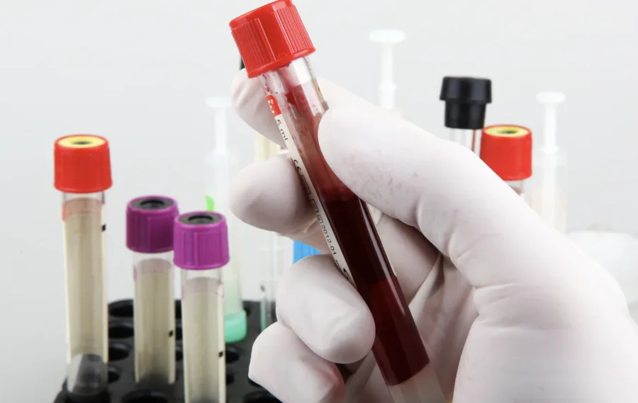 Francisco Morato realiza ação noturna com testagem rápida e prevenção no Dia Mundial contra as Hepatites