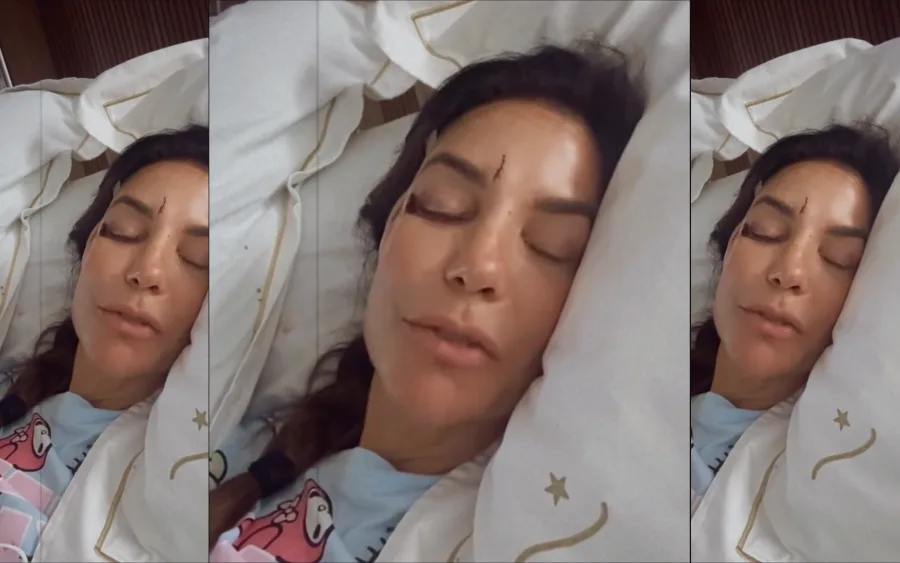 Ivete Sangalo recebe alta após desmaio, surge com olho roxo e explica diagnóstico em Salvador