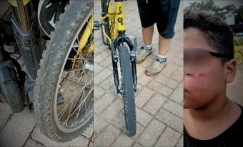 Crianças ficam feridas após suposta falha em bicicletas alugadas no EcoParque de Caieiras