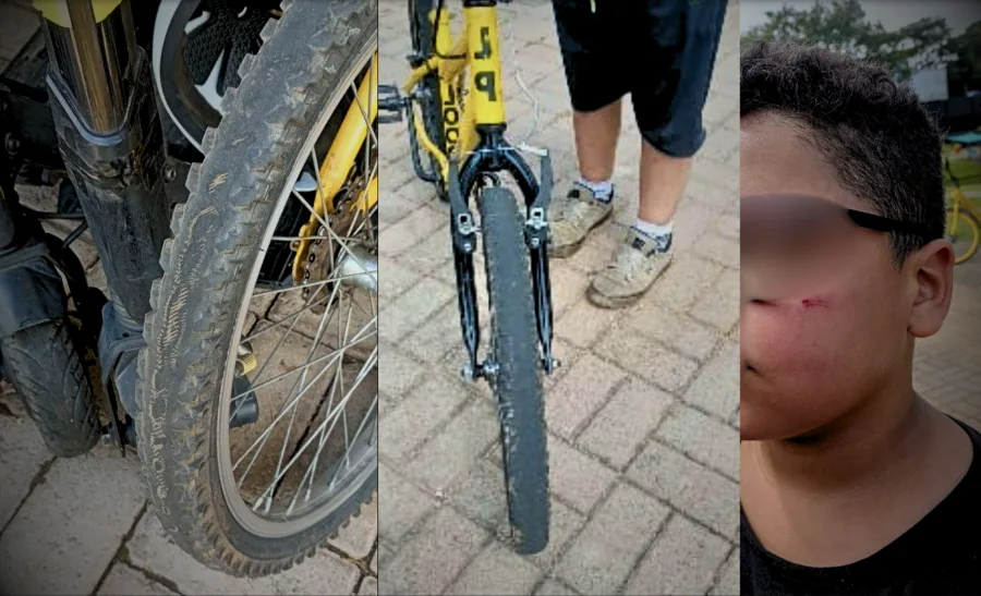 Crianças ficam feridas após suposta falha em bicicletas alugadas no EcoParque de Caieiras