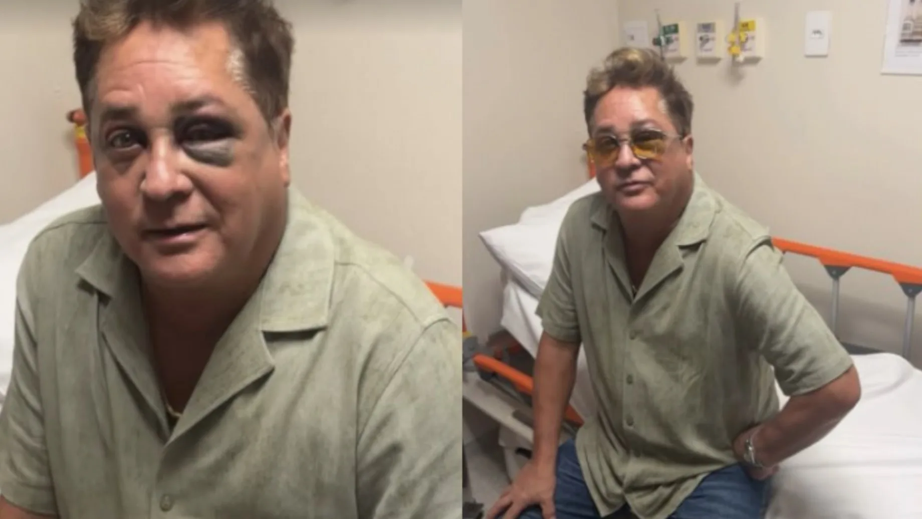 Cantor Leonardo aparece com olho roxo após acidente e situação assusta fãs, o que realmente aconteceu durante pescaria?