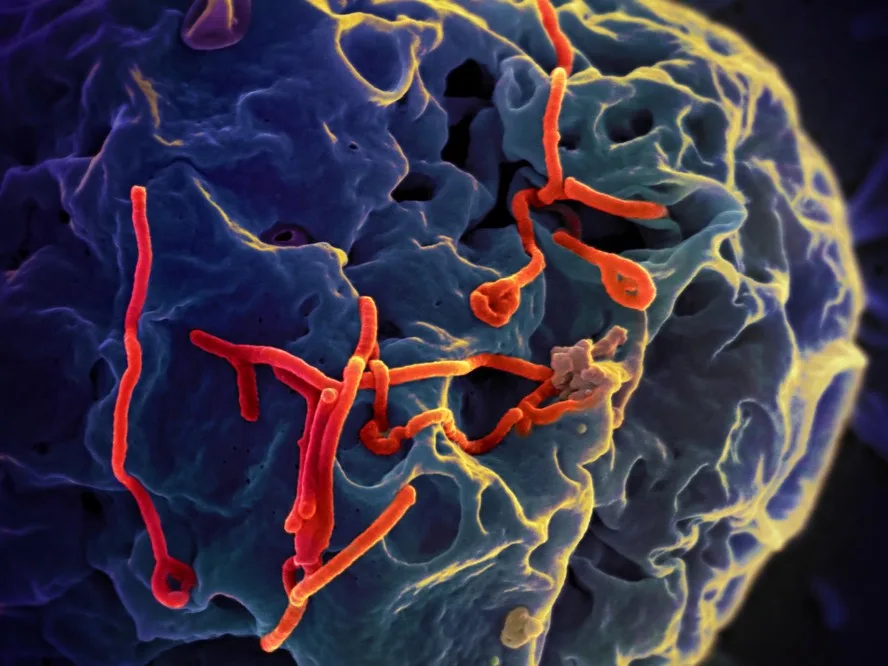 Paciente com suspeita de Ebola é internado em São Paulo após viagem internacional